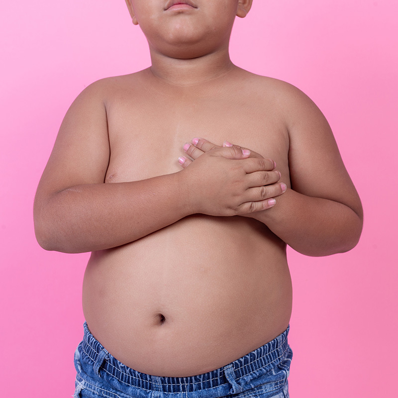 61 Sovrappeso e obesità in età evolutiva